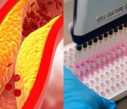 Bilim insanları geliştirdi: Kalp krizi ve felci önleyebilir